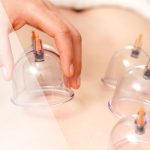 Winning Combination: Cupping & Acupuncture